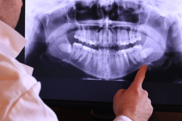 Best Emergency Root Canal Treatment in Woodlake, VA