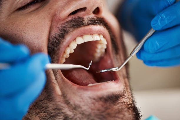 Best Emergency Treatment for Toothache in Woodlake, VA